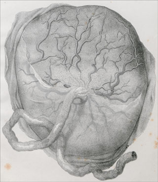 Introimage